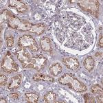 PTHLH Antibody in Immunohistochemistry (IHC)