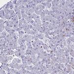 PTHLH Antibody in Immunohistochemistry (IHC)