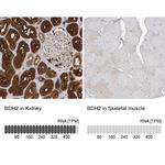 BDH2 Antibody