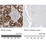 BDH2 Antibody in Immunohistochemistry (IHC)