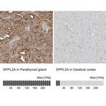 SPPL2A Antibody
