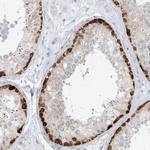 Mgea5 Antibody in Immunohistochemistry (IHC)