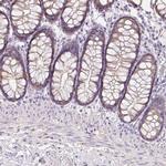 ZBBX Antibody in Immunohistochemistry (IHC)