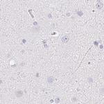 ZBBX Antibody in Immunohistochemistry (IHC)