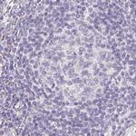 ZBBX Antibody in Immunohistochemistry (IHC)