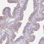 ZBBX Antibody in Immunohistochemistry (IHC)