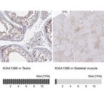 KIAA1586 Antibody in Immunohistochemistry (IHC)