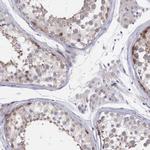 KIAA1586 Antibody in Immunohistochemistry (IHC)