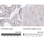 KIAA1586 Antibody