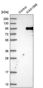 KIAA1586 Antibody in Western Blot (WB)
