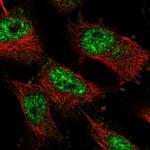 ZNF821 Antibody in Immunocytochemistry (ICC/IF)