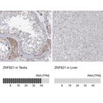 ZNF821 Antibody in Immunohistochemistry (IHC)