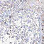 HAAO Antibody in Immunohistochemistry (IHC)