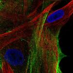 ARSJ Antibody in Immunocytochemistry (ICC/IF)