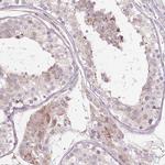 PDZD2 Antibody in Immunohistochemistry (IHC)