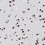 MATR3 Antibody in Immunohistochemistry (IHC)