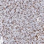 MATR3 Antibody in Immunohistochemistry (IHC)