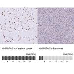 HNRNPA0 Antibody in Immunohistochemistry (IHC)