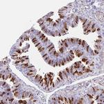 TPPP Antibody in Immunohistochemistry (IHC)