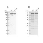 PDS5A Antibody in Western Blot (WB)