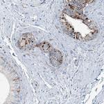 INTU Antibody in Immunohistochemistry (IHC)