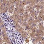 QARS Antibody in Immunohistochemistry (IHC)