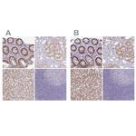 A1CF Antibody in Immunohistochemistry (IHC)