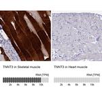 TNNT3 Antibody in Immunohistochemistry (IHC)