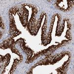 SYTL1 Antibody in Immunohistochemistry (IHC)