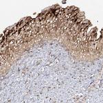 SYTL1 Antibody in Immunohistochemistry (IHC)