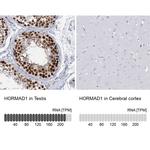 HORMAD1 Antibody in Immunohistochemistry (IHC)