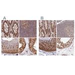 WAPL Antibody in Immunohistochemistry (IHC)