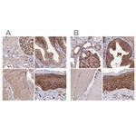 TAB182 Antibody in Immunohistochemistry (IHC)