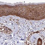 TAB182 Antibody in Immunohistochemistry (IHC)