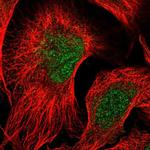 RTKN2 Antibody in Immunocytochemistry (ICC/IF)