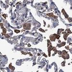 RTKN2 Antibody in Immunohistochemistry (IHC)