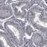 FLVCR2 Antibody in Immunohistochemistry (IHC)