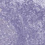 DYDC2 Antibody in Immunohistochemistry (IHC)