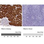 PBLD Antibody in Immunohistochemistry (IHC)