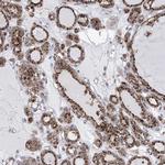 SIAE Antibody in Immunohistochemistry (IHC)