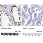 SPATA7 Antibody in Immunohistochemistry (IHC)