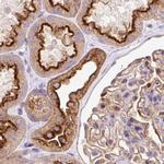 HIP1R Antibody in Immunohistochemistry (IHC)