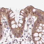 HIP1R Antibody in Immunohistochemistry (IHC)