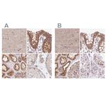 HIP1R Antibody in Immunohistochemistry (IHC)