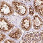 HIP1R Antibody in Immunohistochemistry (IHC)