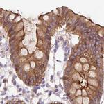 HIP1R Antibody in Immunohistochemistry (IHC)