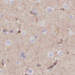 HIP1R Antibody in Immunohistochemistry (IHC)