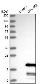 C11orf52 Antibody in Western Blot (WB)