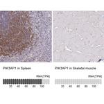 PIK3AP1 Antibody in Immunohistochemistry (IHC)