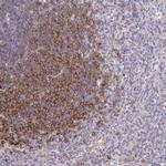 PIK3AP1 Antibody in Immunohistochemistry (IHC)